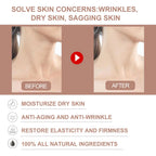 Anti Wrinkle Balm Anti Aging